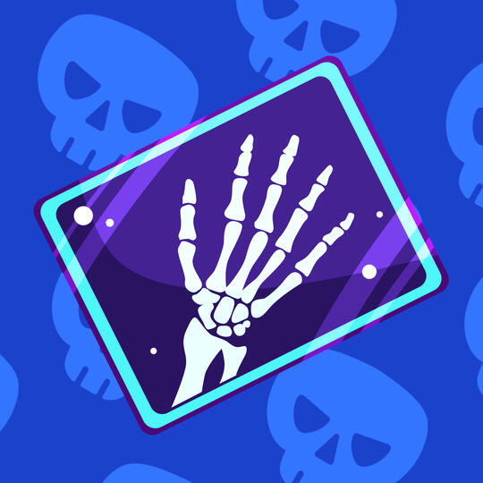 X-Ray